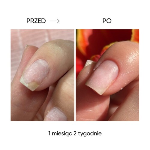 NAILSOFTHEDAY Onistop – olejek przeciwko onycholizie, 8 ml 4