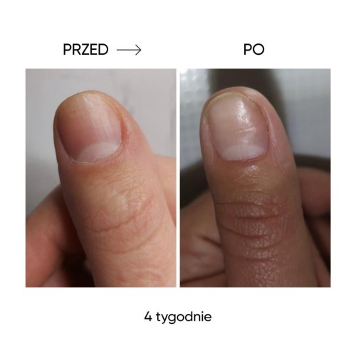 NAILSOFTHEDAY Onistop – olejek przeciwko onycholizie, 8 ml 3