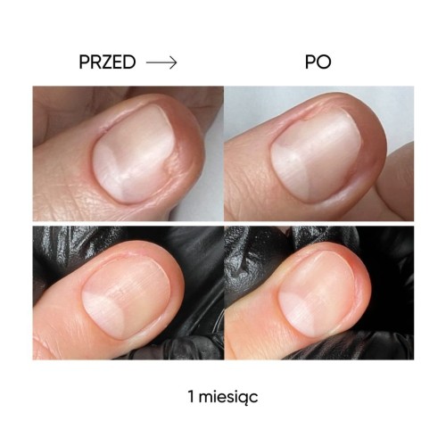 NAILSOFTHEDAY Onistop – olejek przeciwko onycholizie, 8 ml 5