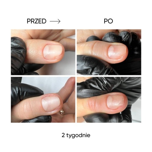 NAILSOFTHEDAY Onistop – olejek przeciwko onycholizie, 8 ml 6
