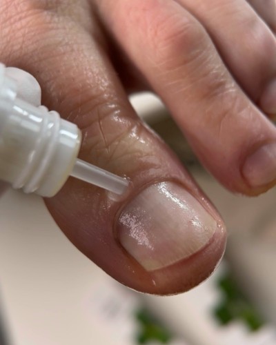 RESULTUM Onistopix Oil - olejek regenerujący dla paznokci z onycholizą, 15 ml